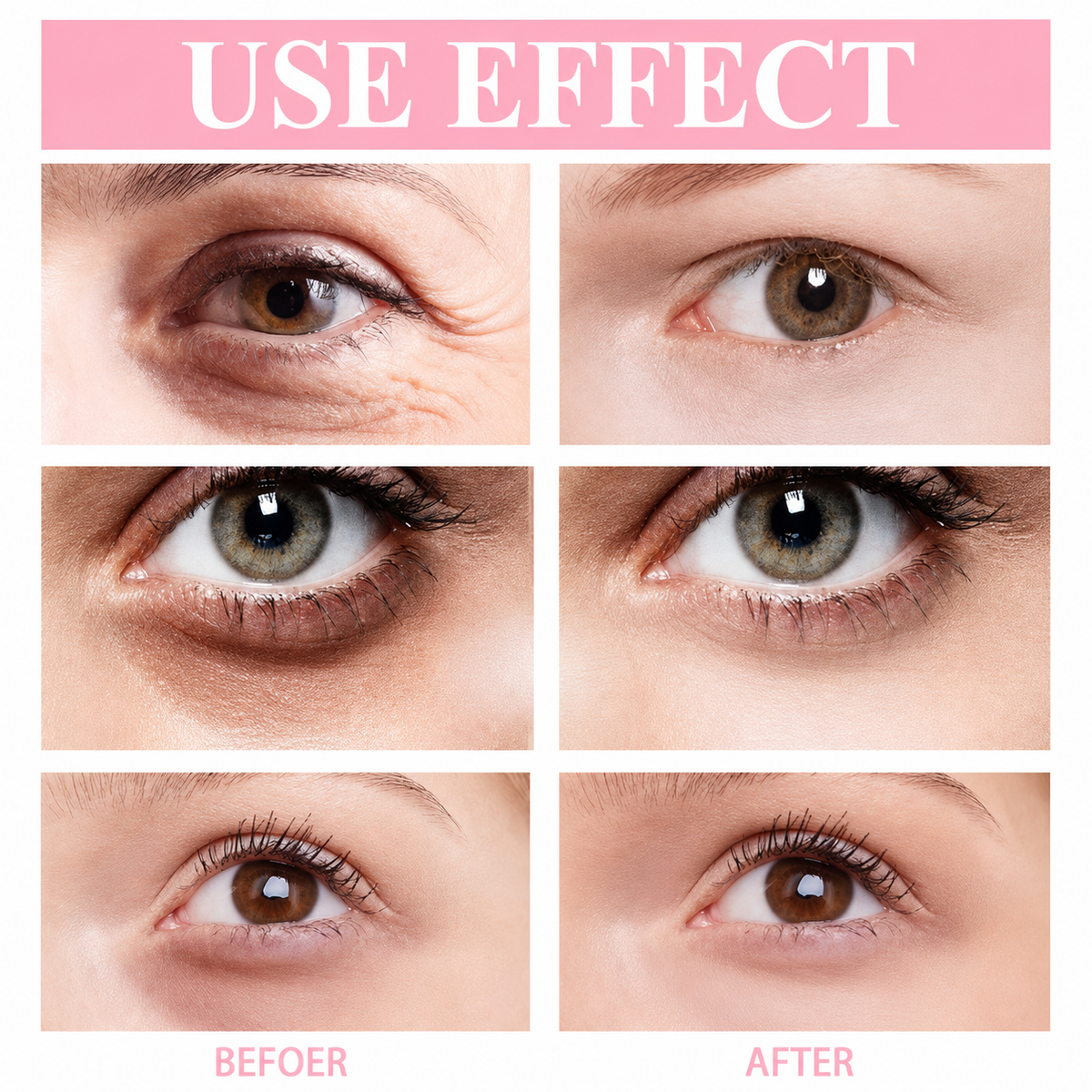 Before and after style eye-area comparison graphic